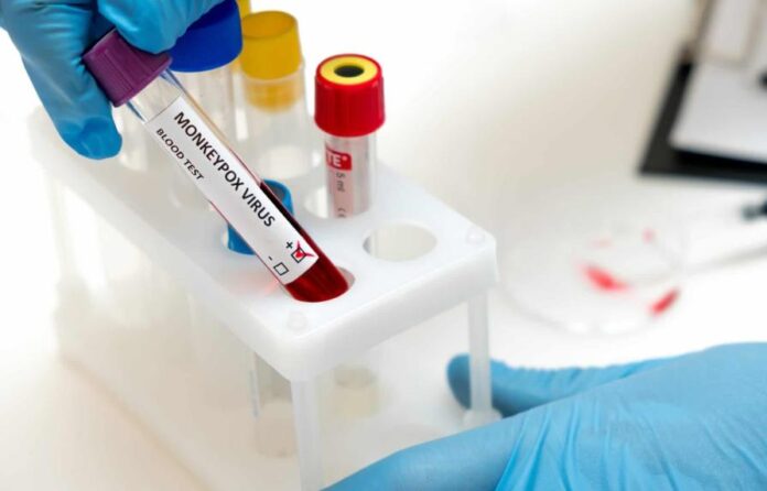 a-medical-worker-holds-a-test-tube-with-blood-infe-2022-05-29-19-41-55-utc-95a10266-focus-0-0-895-573