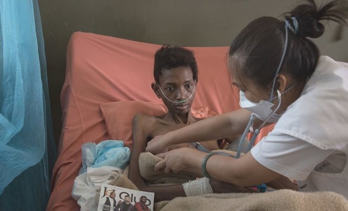 TUBERCULOSIS